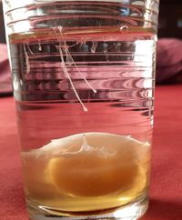 © S. Latussek, Ei im Wasserglas aufgeschlagen zur Eidiagnose